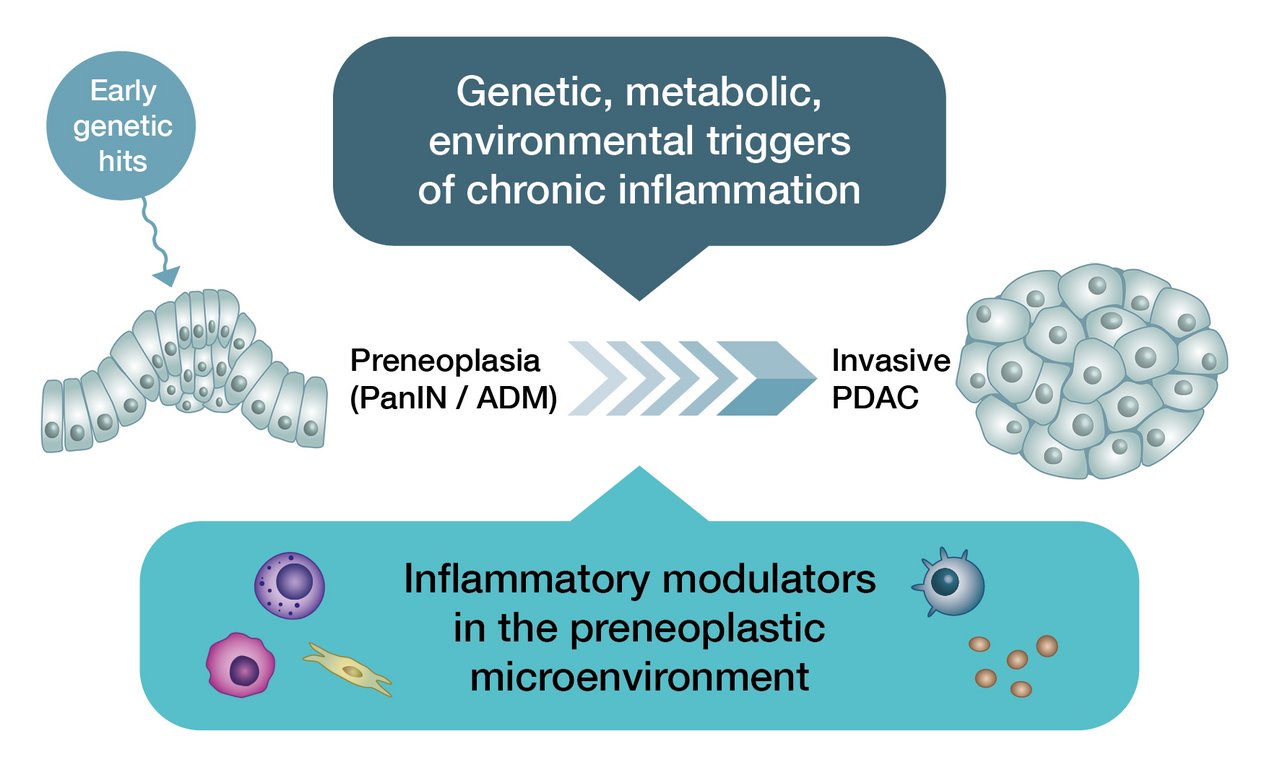The figure schematically depicts an inconspicuous pancreatic tissue from which an invasive pancreatic carcinoma emerges by exposure to genetic, metabolic and exogenous triggers of chronic inflammation. The transition from preneoplasia to invasive PDAC is influenced by inflammatory modulators.